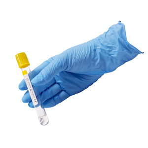 Is Nitrile Gloves Chemical Resistant?